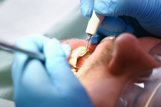 Best Knocked-Out Tooth Emergency  in Fleetwood, PA